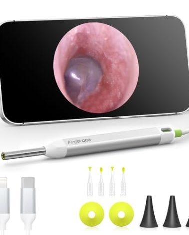 AnyScope HD Digital Otoscope, Video Ear Scope Otoscope with Light, Ultra Clear View Ear Camera with Ear Wax Removal Tools, Compatible with iPhone and Android Devices (Silver) ﻿