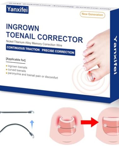 Nitinol Ingrown Toenail Corrector,at Home Ingrown Toenail Treatment,Curved Toenail Straightener,Ingrown Toe Nail Relief，Ingrown Toenail Removal Kit (1/2 In,11/16 In)