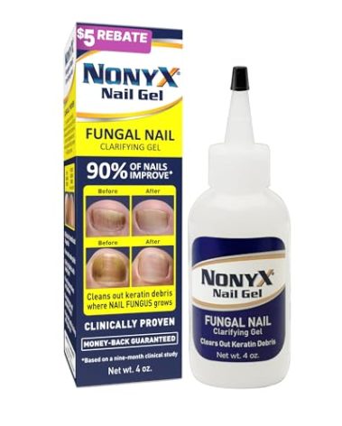 NONYX Fungal Nail Clarifying Gel | Clinically Proven for Discolored, Thick, Brittle, Yellow, Lifted, and other signs of Fungus-Damaged Toenails | 90% of Nails Improve | Over 8 million sold
