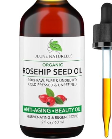 Rosehip Oil - Pure, Virgin, Cold Pressed - From Whole Berries (Pulp & Seeds), Natural Deep Orange Hue for Intensive Skin Repair - Undiluted Organic Rosehip Seed Oil, 2 oz