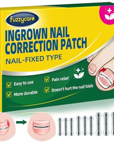 Titanium Alloy Ingrown Toenail Treatment & Removal Kit for Quick Relief, Ingrown Toenail Removal Kit， Professional Ingrown Toenail Corrector, Ingrown Toenail Tools for Quick Relief, 10 Pcs