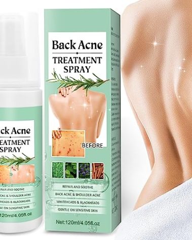 Back Acne Treatment Spray With Herbal Formula, 2% Salicylic Acid & Tea Tree Oil - Body Acne Solution, 120ml