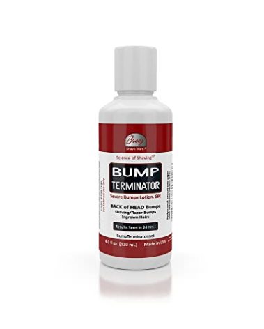 Bump Terminator Severe Bumps Lotion (4oz)
