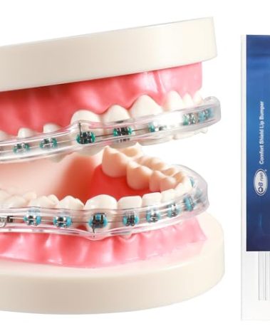 B Rush Comfort Cover for Braces -Orthodontic Lip Bumper, Lip Shield, Mouth Guard for Brackets, Wax Alternative-Dental Lip Protector