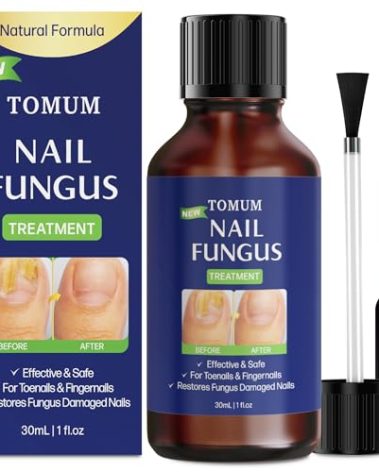 Toe finger nail fungal treatment: hongos fungal remover extra strength liquid - repair damaged fungus nail with brush (30ml/1fl oz)