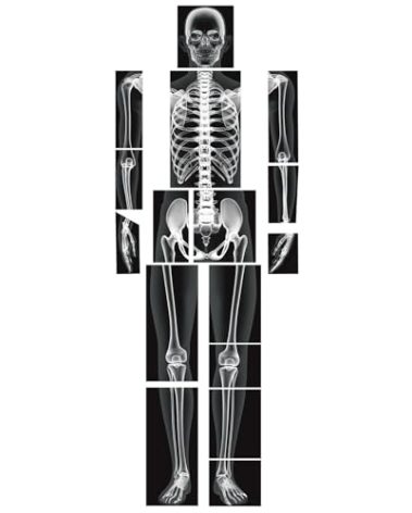 Lineshading 16 Pieces Human X Rays Bones X Rays Human Xrays for Kids Human Bones Body Display Play Table, Black and White