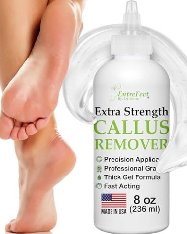 Dr. Entre's Callus Remover Gel: 8oz Extra Strength with Precision Applicator, Callus Remover for Feet, Foot Callus Remover, Foot Care, Pedicure Tools Supplies, Dead Skin Remover